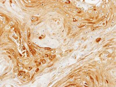 Immunohistochemistry-Paraffin: PDK3 Antibody [NBP1-32581]