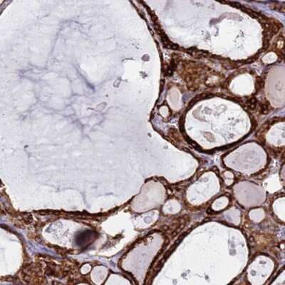 Immunohistochemistry-Paraffin: PDK3 Antibody [NBP2-13745]
