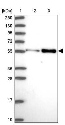 Western Blot: PDK3 Antibody [NBP2-13745]