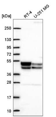 Western Blot: PDK3 Antibody [NBP2-56356]