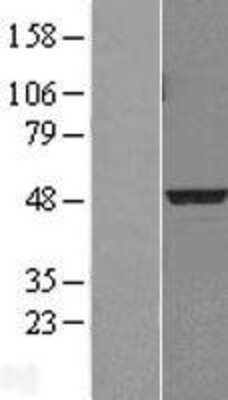 Western Blot: PDK3 Overexpression Lysate [NBL1-14251]