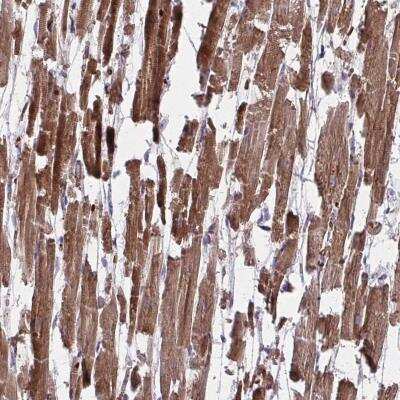 Immunohistochemistry-Paraffin: PDK4 Antibody [NBP2-49235]