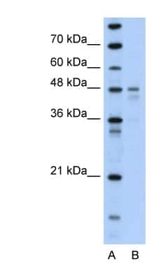 Western Blot: PDK4 Antibody [NBP1-54723]