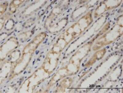 Immunohistochemistry-Paraffin: PDLIM1 Antibody (2D4) [H00009124-M02]
