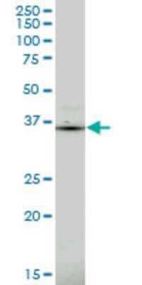 Western Blot: PDLIM1 Antibody (2D4) [H00009124-M02]