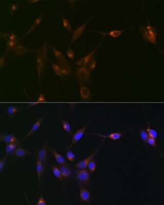 Immunocytochemistry/ Immunofluorescence: PDLIM1 Antibody (5X10L2) [NBP3-15689]
