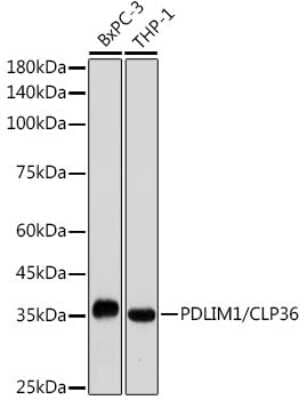 Western Blot: PDLIM1 Antibody (5X10L2) [NBP3-15689]