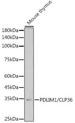 Western Blot: PDLIM1 Antibody (5X10L2) [NBP3-15689]