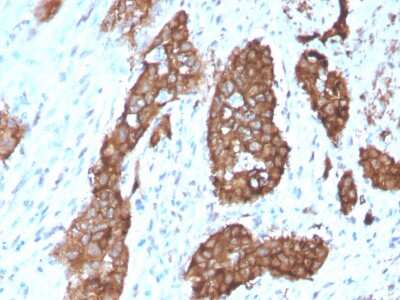 Immunohistochemistry-Paraffin: PDLIM1 Antibody (CPTC-PDLIM1-1) - Azide and BSA Free [NBP3-08842]