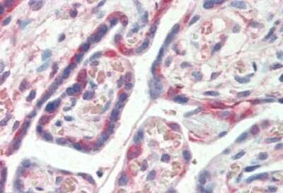 Immunohistochemistry-Paraffin: PDLIM1 Antibody [NBP1-51917]