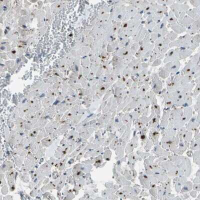 Immunohistochemistry-Paraffin: PDLIM1 Antibody [NBP1-84443]