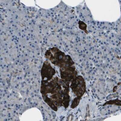Immunohistochemistry-Paraffin: PDLIM1 Antibody [NBP1-84443]