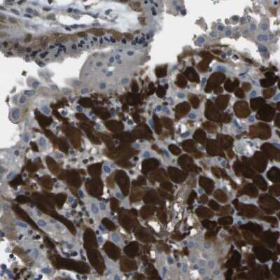 Immunohistochemistry-Paraffin: PDLIM1 Antibody [NBP1-84443]