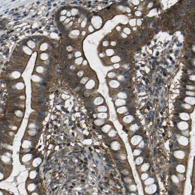 Immunohistochemistry-Paraffin: PDLIM1 Antibody [NBP1-84443]