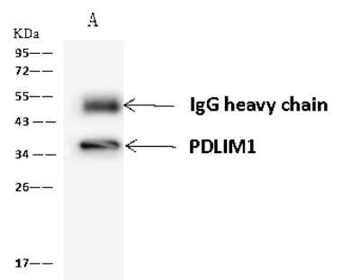 Immunoprecipitation: PDLIM1 Antibody [NBP2-98546]