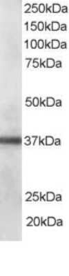 Western Blot: PDLIM1 Antibody [NBP1-51917]