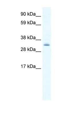 Western Blot: PDLIM1 Antibody [NBP1-80239]