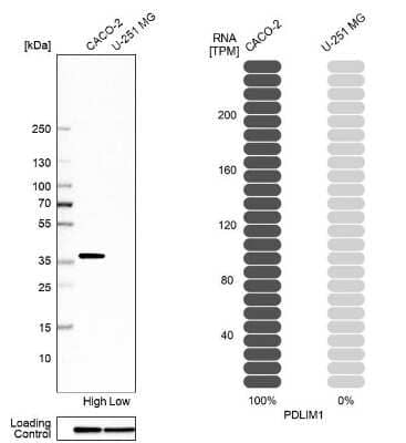 Western Blot: PDLIM1 Antibody [NBP1-84443]