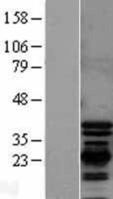 Western Blot: PDLIM1 Overexpression Lysate [NBL1-14253]