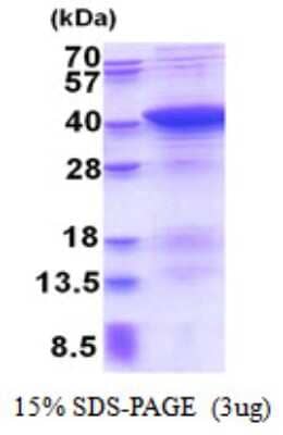 SDS-PAGE: Recombinant Human PDLIM1 His Protein [NBP2-51543]