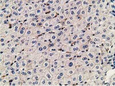 Immunohistochemistry-Paraffin: PDLIM2 Antibody (OTI11A12) [NBP2-00619]