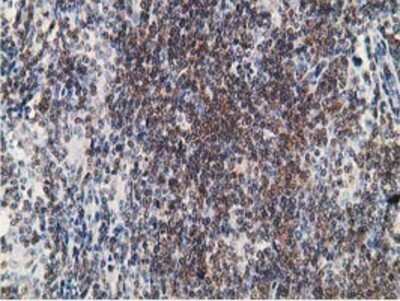 Immunohistochemistry-Paraffin: PDLIM2 Antibody (OTI11A12) [NBP2-00619]