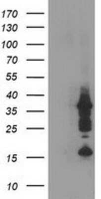 Western Blot: PDLIM2 Antibody (OTI11A12) [NBP2-00619]