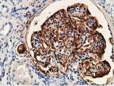 Immunohistochemistry: PDLIM2 Antibody (OTI11A12) - Azide and BSA Free [NBP2-73311]