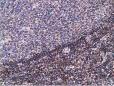 Immunohistochemistry: PDLIM2 Antibody (OTI11A12) - Azide and BSA Free [NBP2-73311]