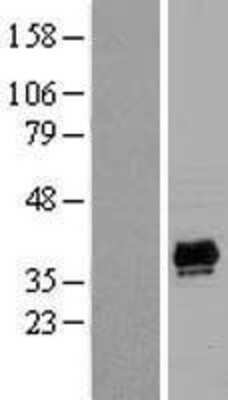 Western Blot: PDLIM2 Overexpression Lysate [NBL1-14254]