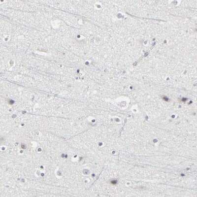 Immunohistochemistry-Paraffin: PDLIM3 Antibody [NBP1-89134]
