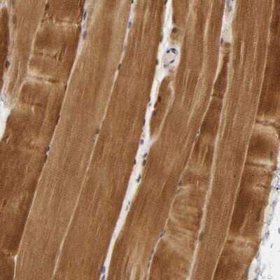 Immunohistochemistry-Paraffin: PDLIM3 Antibody [NBP1-89134]