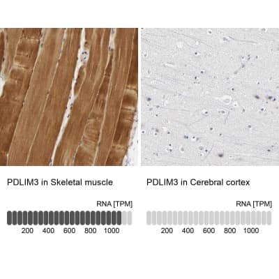 Immunohistochemistry-Paraffin: PDLIM3 Antibody [NBP1-89134]