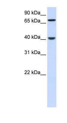 Western Blot: PDLIM3 Antibody [NBP1-55197]