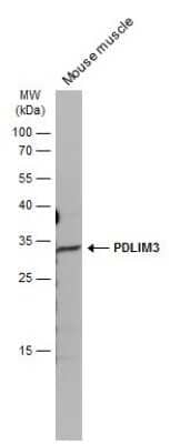 Western Blot: PDLIM3 Antibody [NBP2-19755]