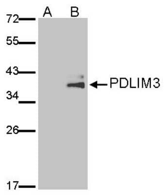 Western Blot: PDLIM3 Antibody [NBP2-19757]