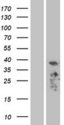 Western Blot: PDLIM3 Overexpression Lysate [NBP2-04344]