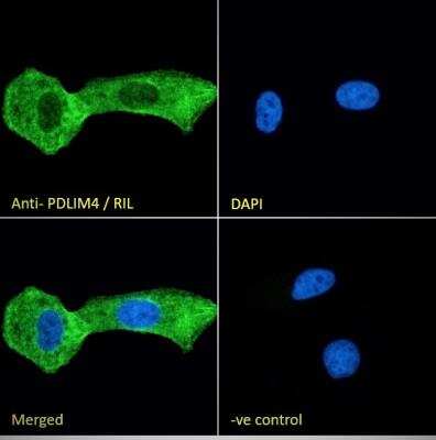 Immunocytochemistry/ Immunofluorescence: PDLIM4 Antibody [NB100-1382]