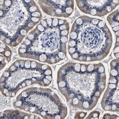 Immunohistochemistry-Paraffin: PDLIM4 Antibody [NBP1-80833]
