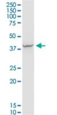 Western Blot: PDLIM4 Antibody [H00008572-B01P]