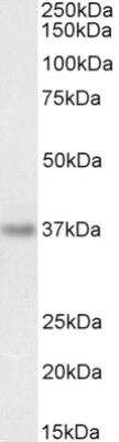 Western Blot: PDLIM4 Antibody [NB100-1382]