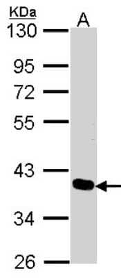 Western Blot: PDLIM4 Antibody [NBP2-19759]