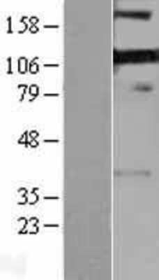 Western Blot: PDLIM4 Overexpression Lysate [NBP2-04255]