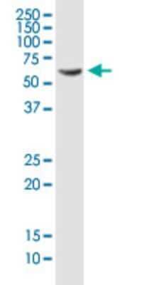 Western Blot: PDLIM5 Antibody (3E11-F6) [H00010611-M01]