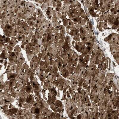 Immunohistochemistry-Paraffin: PDLIM5 Antibody [NBP1-84843]