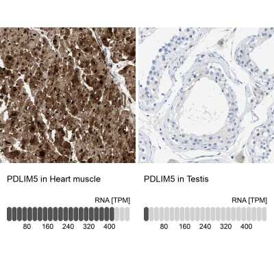 Immunohistochemistry-Paraffin: PDLIM5 Antibody [NBP1-84843]