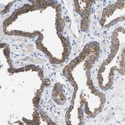 Immunohistochemistry-Paraffin: PDLIM5 Antibody [NBP1-84843]