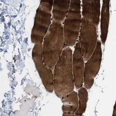 Immunohistochemistry-Paraffin: PDLIM5 Antibody [NBP1-84843]