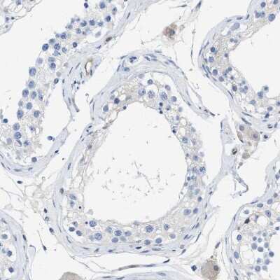 Immunohistochemistry-Paraffin: PDLIM5 Antibody [NBP1-84843]