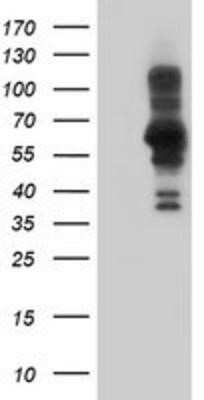 Western Blot: PDLIM5 Antibody (OTI1H10)Azide and BSA Free [NBP2-73317]